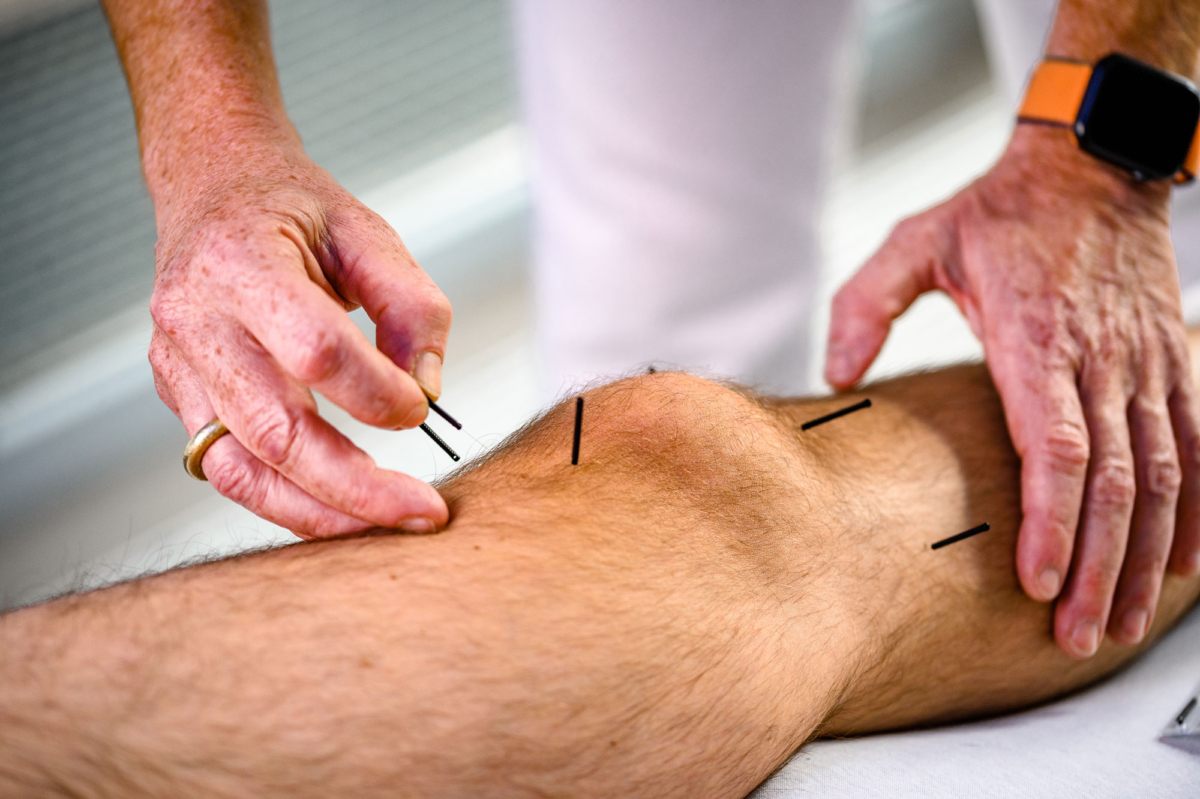 Akupunktur wird am Knie eines Patienten in der Orthopädie ALBERTUS ZENTRUM in Mönchengladbach durchgeführt