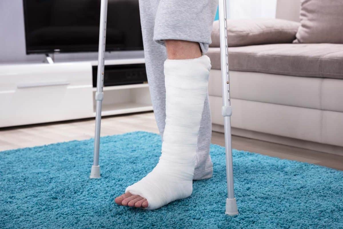 Gipserverband nach ambulanter Fußoperation in Mönchengladbach